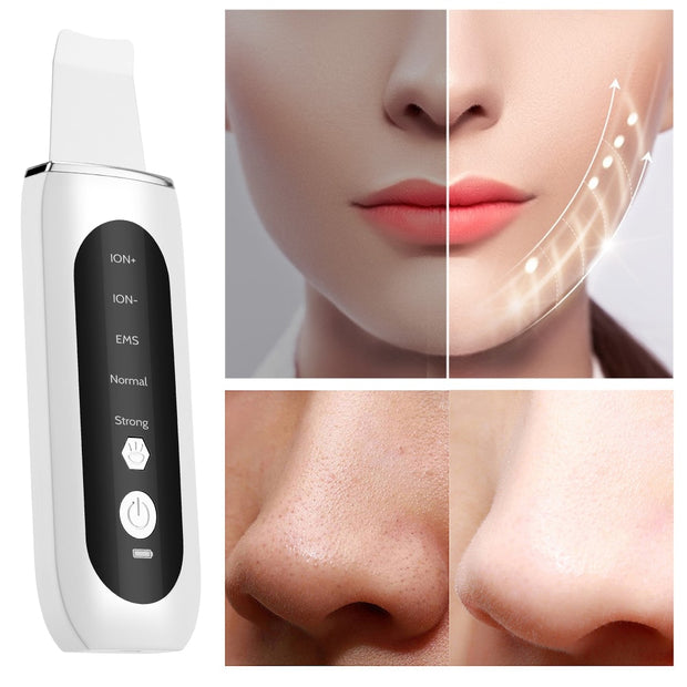 Ultrasonic Face Skin Scrubber - MagicSkinTech